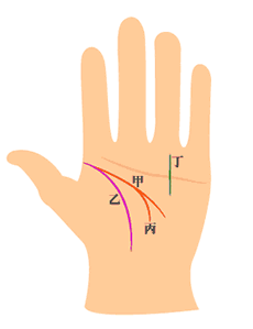 智慧线和生命线相交