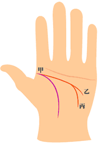 智慧线与生命线起点相交(甲)，尾端分成两条，一条到达无名指下方的人 智慧线与生命线起点相交(甲)，尾端分成两条，另一条垂入干宫