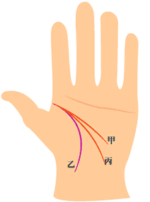 智慧线(甲)与生命线(乙)起点相交， 智慧线又有两条(丙)，且下垂到干宫