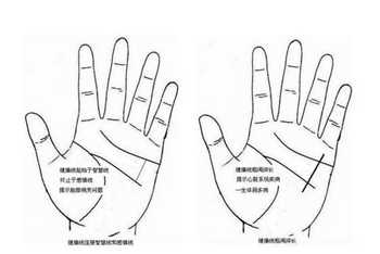 健康线,健康状况,手相分析