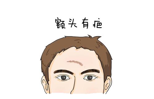 额头有疤痕是什么意思？